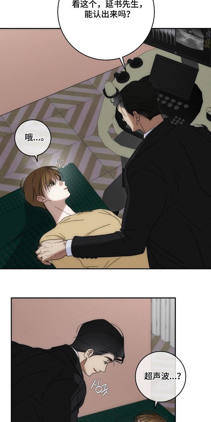 第35话3
